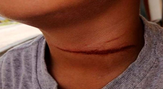 Niño buleador le corta el cuello a uno de sus compañeros