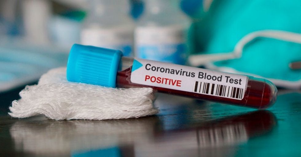 ¿Tu sangre es tipo A?... pues corres más riesgo de contraer coronavirus