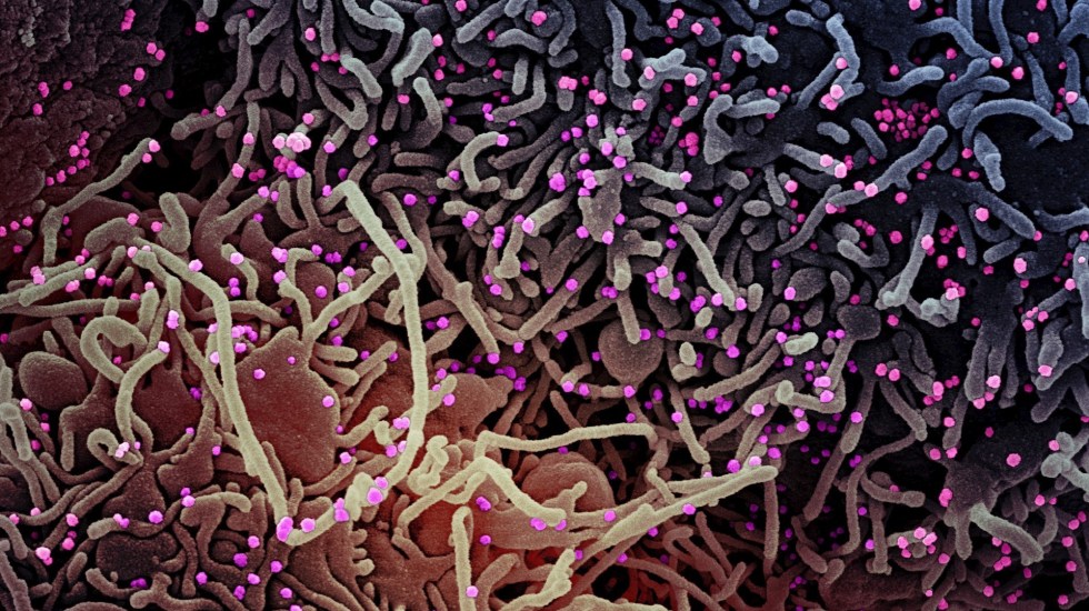 COVID-19 no ha mutado en diferentes tipos de virus, según estudio